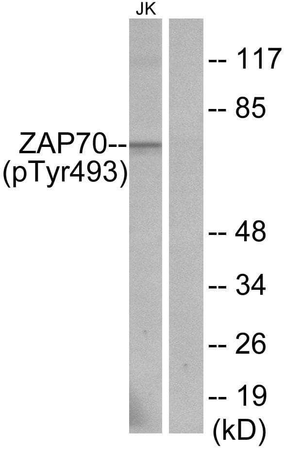 ZAP70 Antibody (phospho-Tyr493)