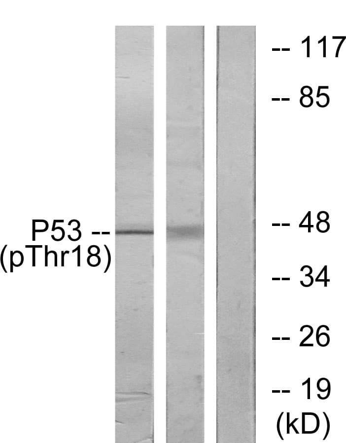 Polyclonal Rabbit anti-Human TP53 / p53 Antibody (phospho-Thr18, WB)