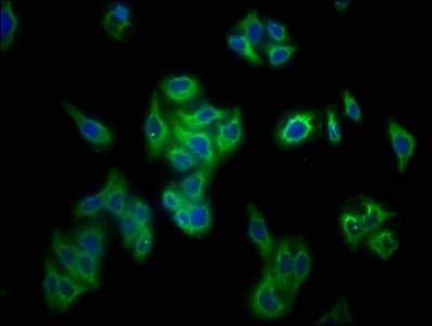 PRF1 / Perforin Antibody