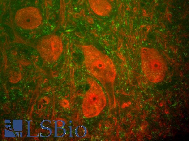 UCHL1 / PGP9.5 Antibody (clone BH7)