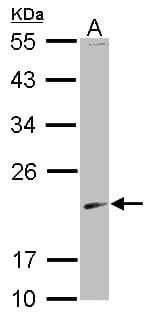 SKP1 Antibody