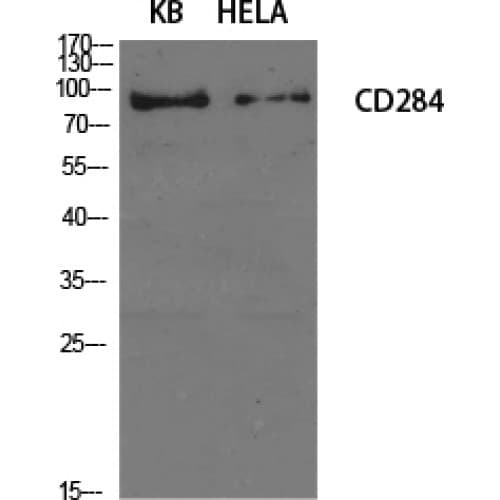 Polyclonal Rabbit anti-Human TLR4 Antibody (Internal, IHC, WB)