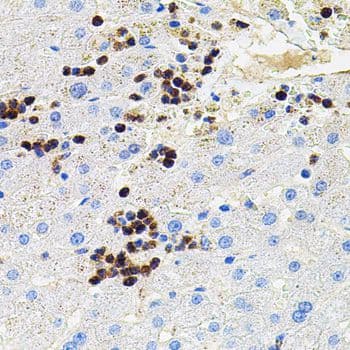 MMP9 / Gelatinase B Antibody