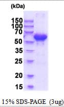 Human SUOX / Sulfite Oxidase Protein (Recombinant His)