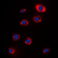 Polyclonal Rabbit anti-Human RPS12 / Ribosomal Protein S12 Antibody (C-Terminus, IHC, IF, WB)