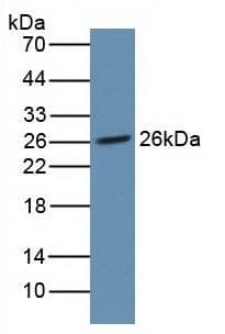 NOG / Noggin Antibody (aa28-232)