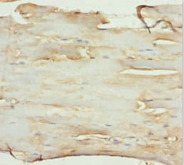 SLC1A5 / ASCT2 Antibody
