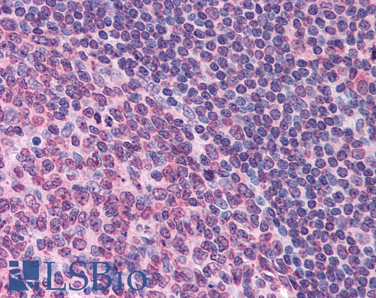 IHC-plus™ FPR1 / FPR Antibody (Extracellular Domain)