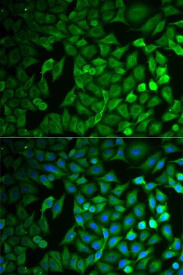 FBXO11 Antibody