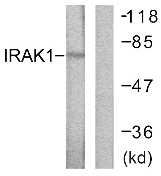 IRAK1 / IRAK Antibody (aa353-402)