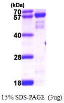 Human NMT2 Protein (Recombinant His)
