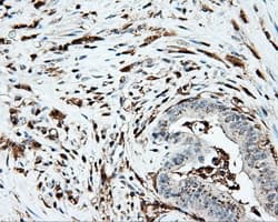PLEK / Pleckstrin Antibody (clone OTI6H8)