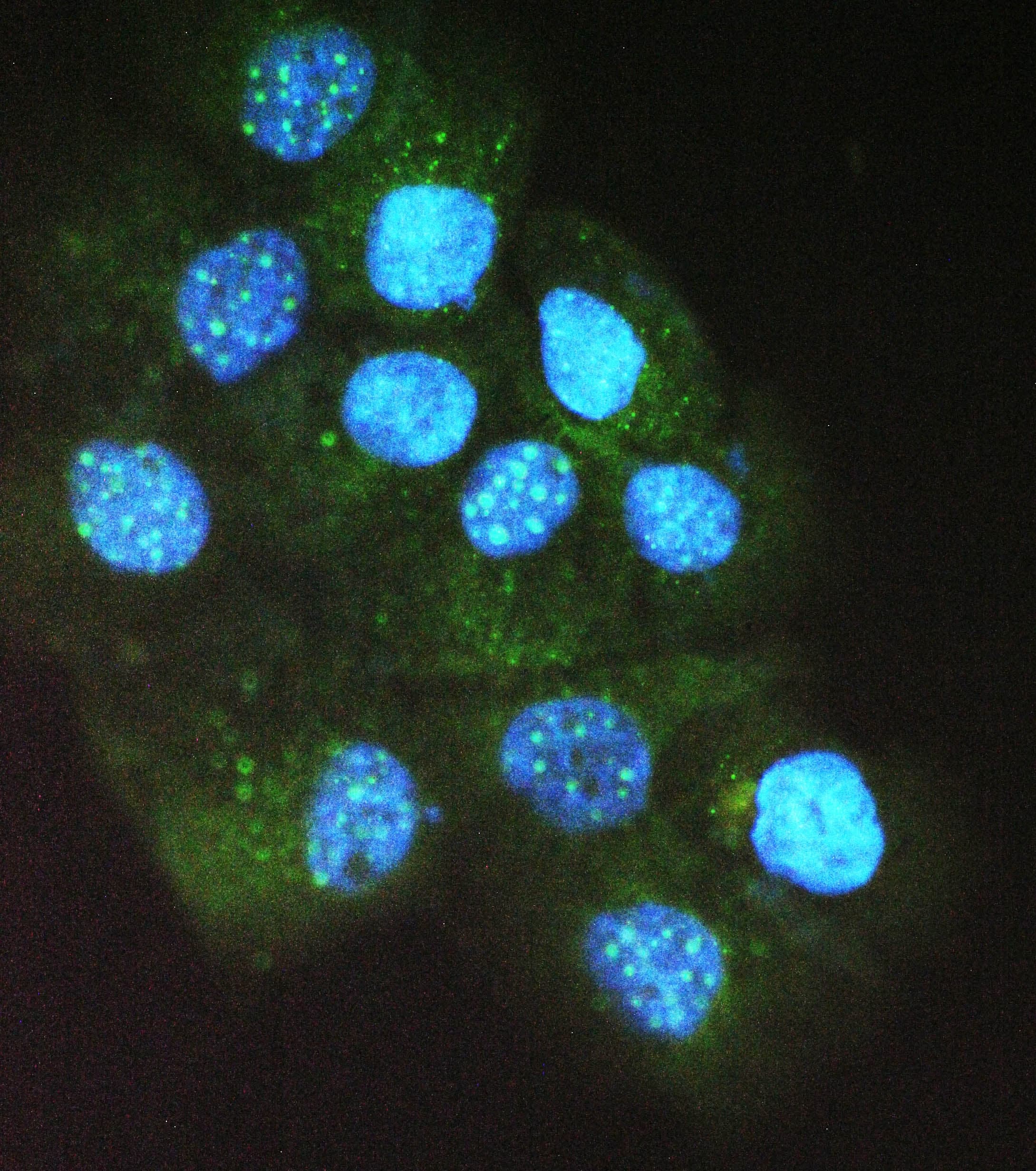 ABL2 Antibody