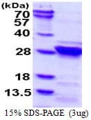 Human RGS4 Protein (Recombinant His)