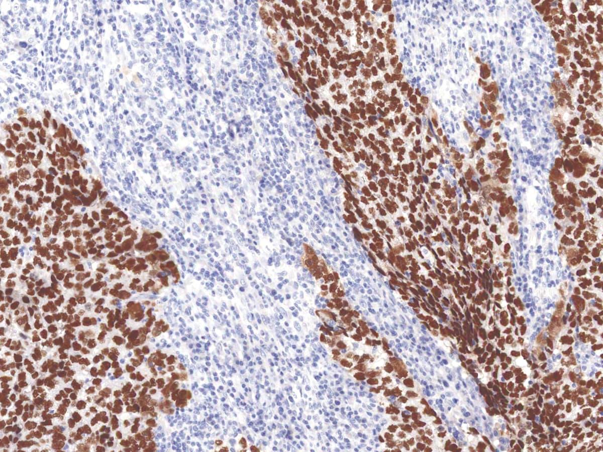SALL4 Antibody (Concentrated)