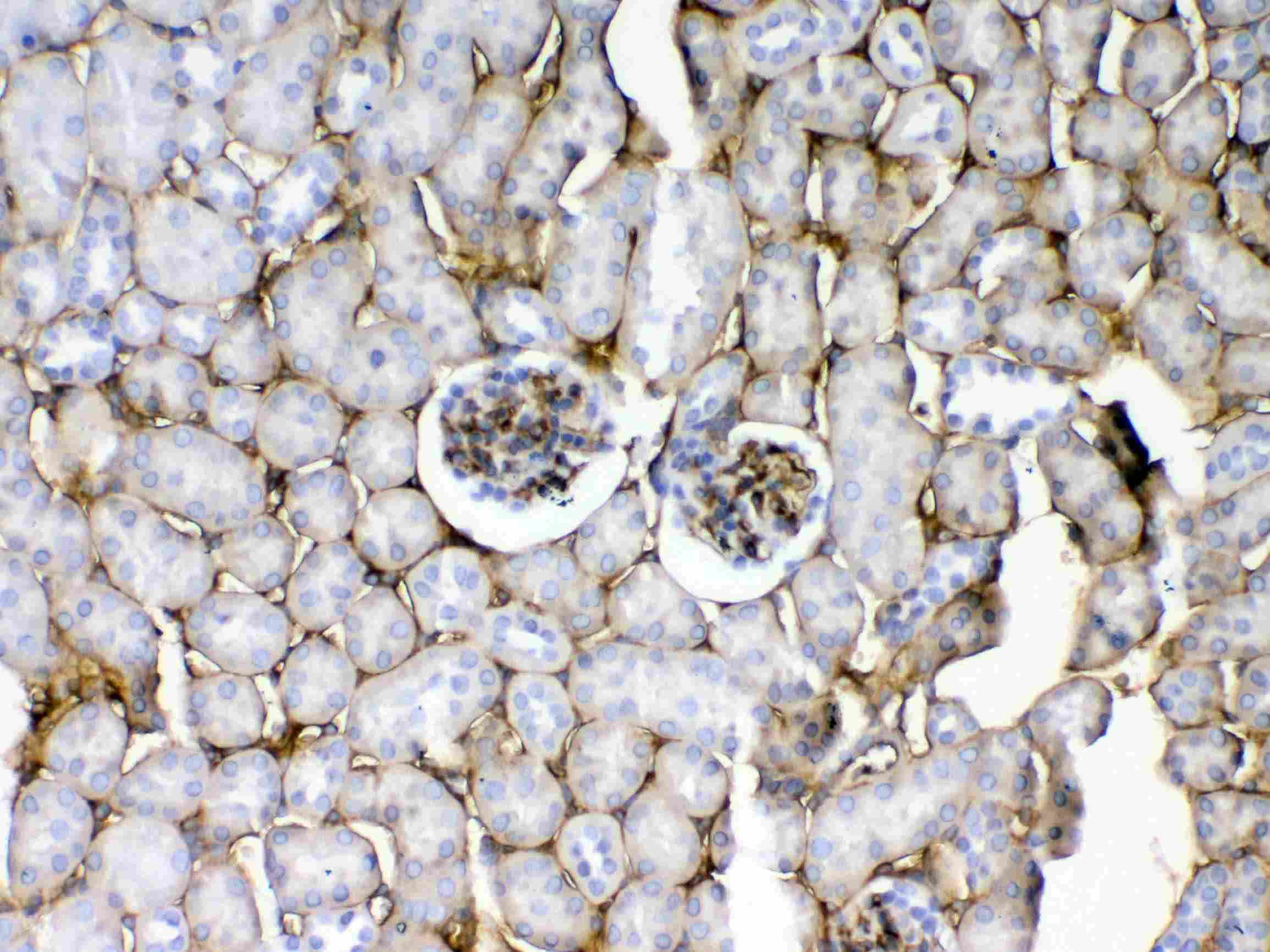 CD105 Antibody