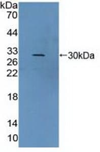VWA2 Antibody (aa1498-1665)
