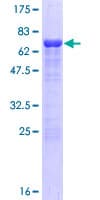 Human SSDP1 / SSBP3 Protein (Recombinant GST)