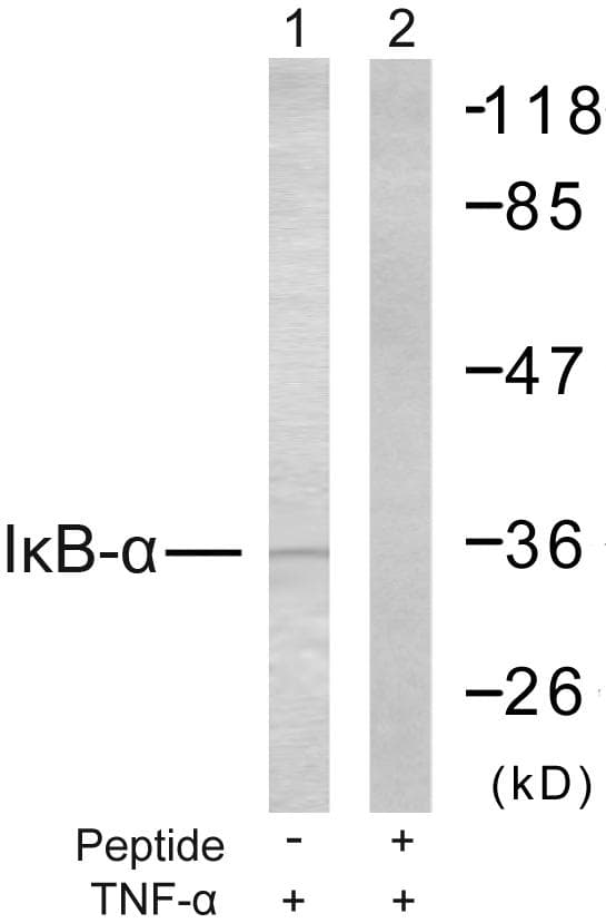 Polyclonal Rabbit anti-Human NFKBIA / IKB Alpha / IKBA Antibody (p32/36, IHC, WB)