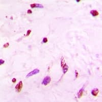 PRPF8 Antibody