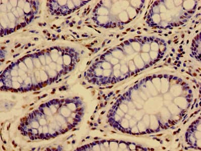 HIST1H3A Antibody
