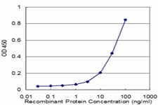 MPP1 Antibody (clone 1E11-1G11)