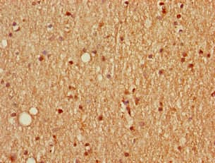 SCGN / Secretagogin Antibody