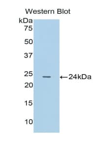 CTSB / Cathepsin B Antibody (aa129-333)