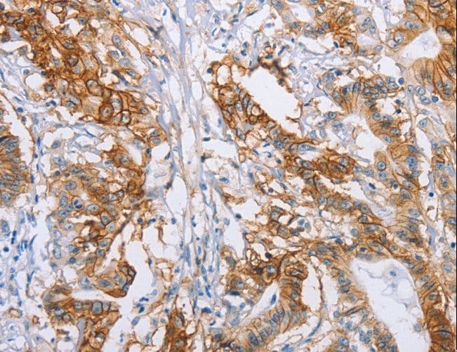 CA9 / Carbonic Anhydrase IX Antibody