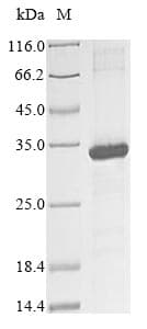 Human KIR2DS3 Protein (Recombinant 10His, N-terminus + Myc, C-terminus)