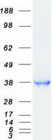 Human CD207 / Langerin Protein (Recombinant Myc-DDK (Flag), C-terminus)