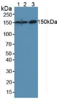 CEA / Carcinoembryonic Antigen Antibody (aa544-771, APC)
