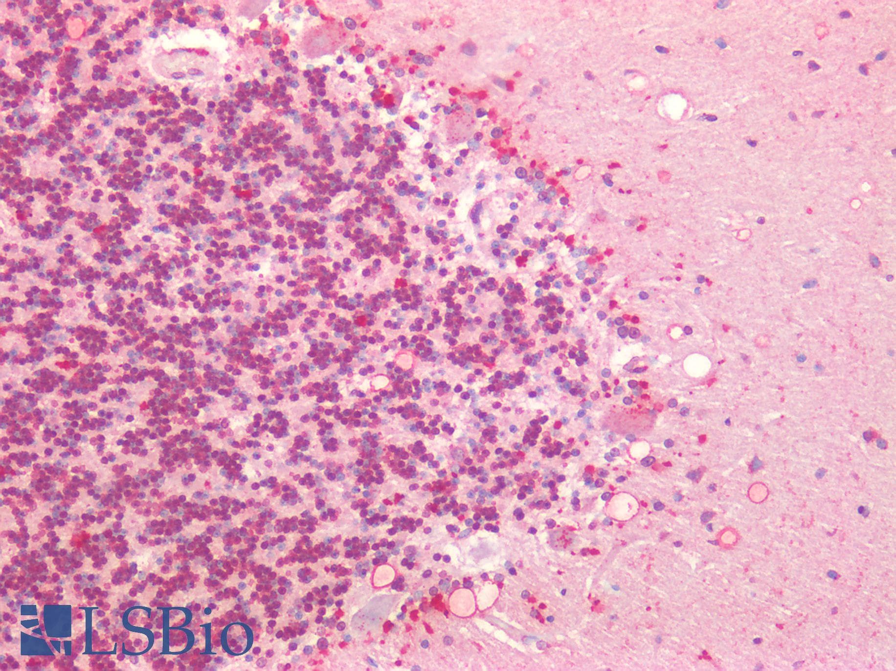 IHC-plus™ Polyclonal Rabbit anti-Rat HTR1A / 5-HT1A Receptor Antibody (Internal, IHC, WB)