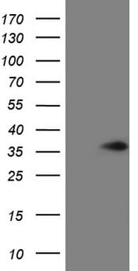 VAPB Antibody (aa2-223, clone OTI4C8)