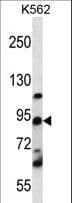 UBTF / UBF Antibody (aa631-660)