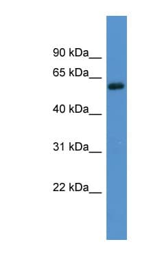 Polyclonal Rabbit anti-Human ADRA1B / Adrenoceptor alpha 1B Antibody (aa388-437, WB)