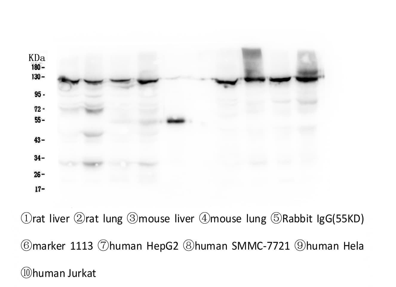 XPO1 / CRM1 Antibody
