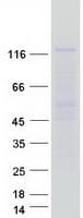Human HPS5 Protein (Recombinant Myc-DDK (Flag))