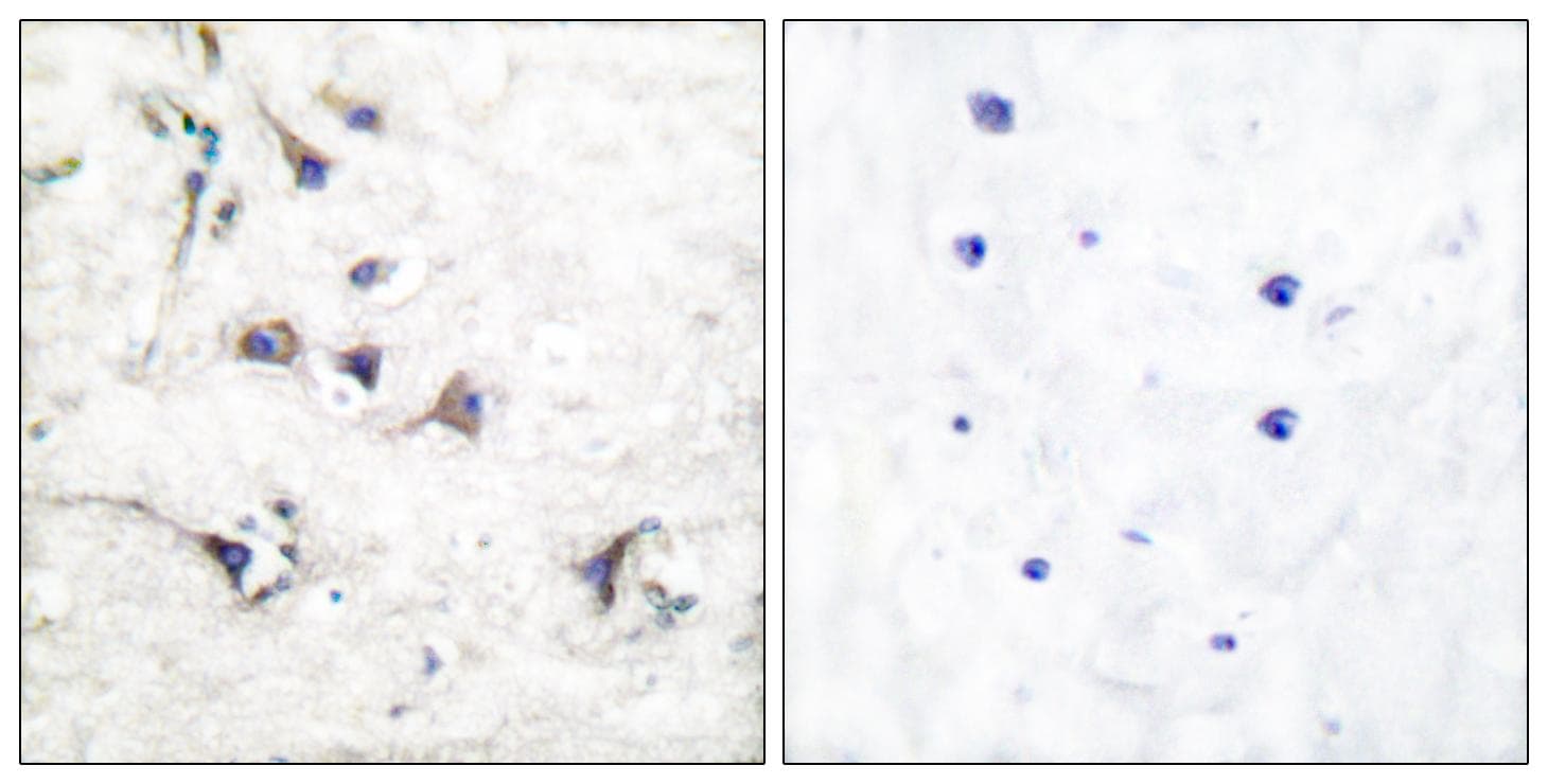 EZR / Ezrin Antibody