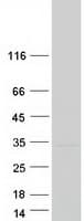 Human TMEM41B Protein (Recombinant Myc-DDK (Flag))