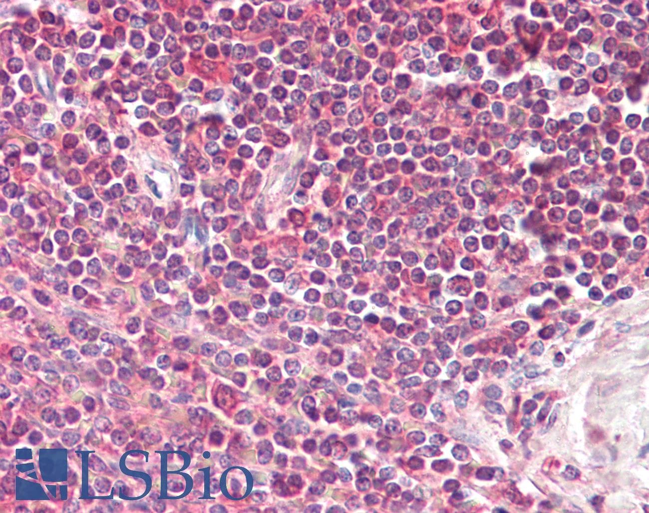IHC-plus™ Polyclonal Goat anti-Human LIMS2 Antibody (aa24-33, IHC)