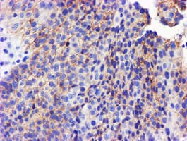 GSTO2 Antibody (clone OTI2A12)