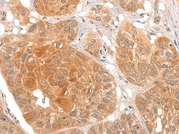 NOG / Noggin Antibody