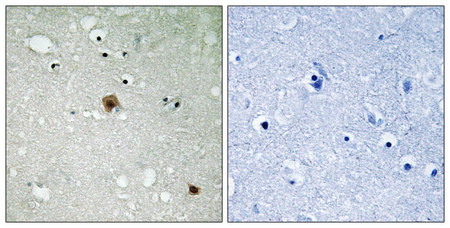 Polyclonal Rabbit anti-Human TOP2A / Topoisomerase II Alpha Antibody (phospho-Ser1525, IHC, WB)