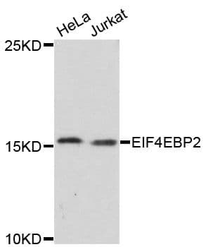 4E-BP2 / EIF4EBP2 Antibody
