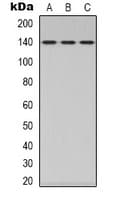 Polyclonal Rabbit anti-Human PPP1R12A / MYPT1 Antibody (Internal, IHC, WB)