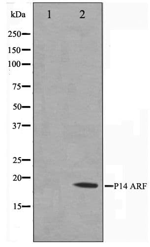 p14ARF / CDKN2A Antibody