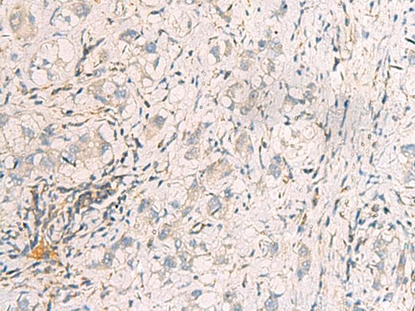 Polyclonal Rabbit anti-Human SUSD3 Antibody (IHC)