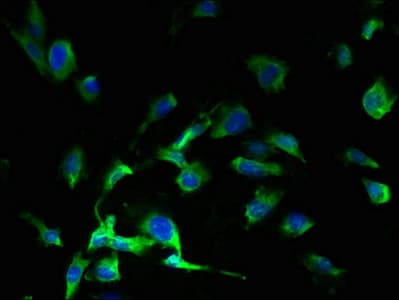 SLC38A7 Antibody