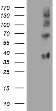 FOLR3 Antibody (clone OTI6C1)